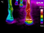 Thermal Equine Survey, Abscess in foot